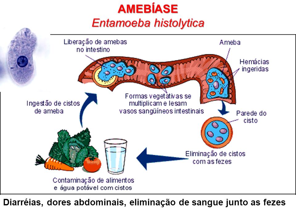 Formas de infecção da Amebíase