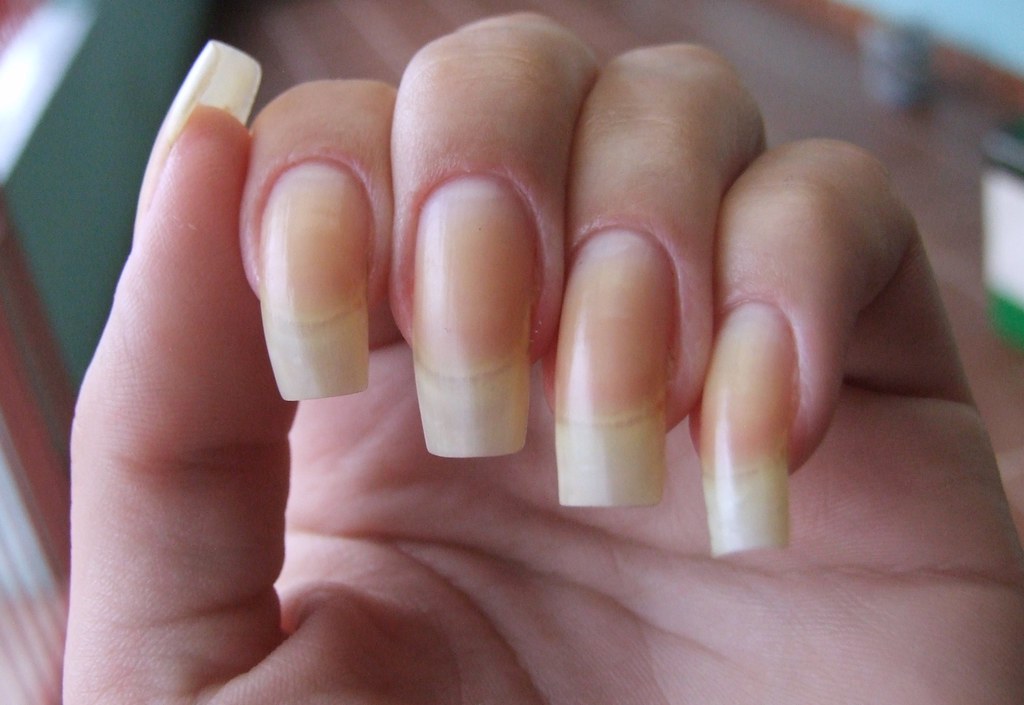 Cuidados com as unhas!