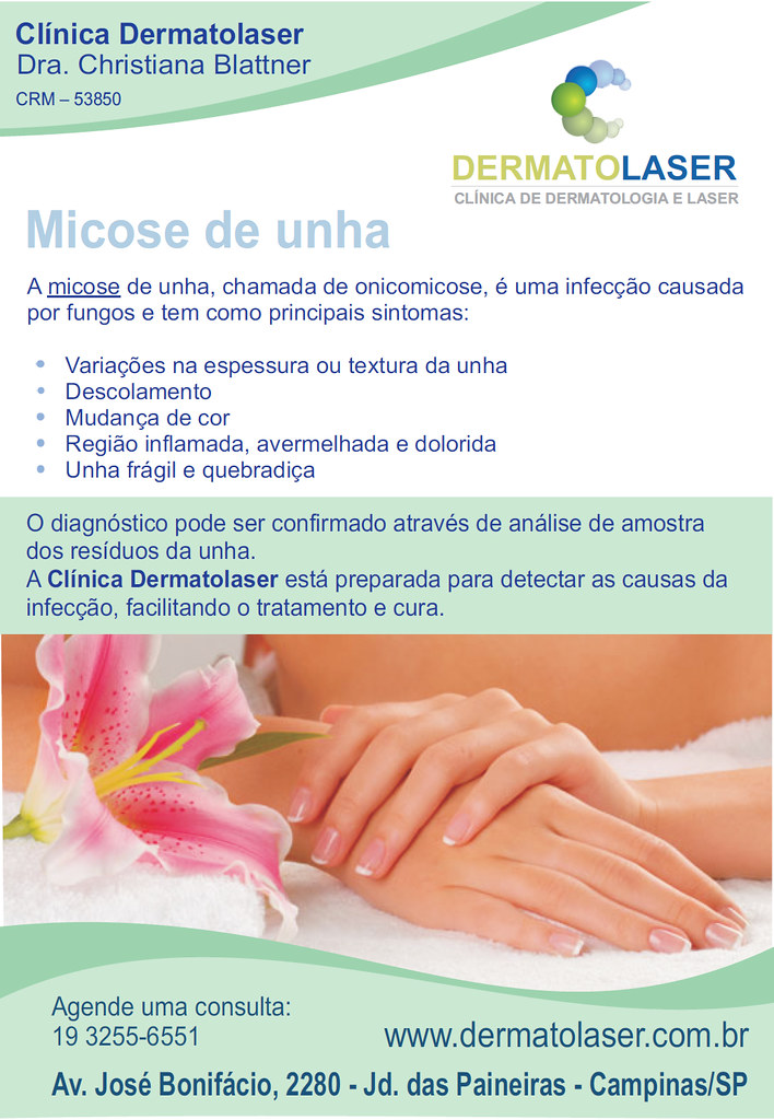 DERMATOLASER - Micose de Unhas