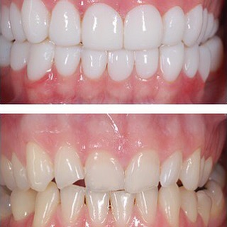 @clinicaswhite : PBX +57(1)6222293 : http://ift.tt/1F9NXpp : clinicaswhite.com